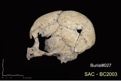 คำบรรยายภาพ : ภาพด้านข้างซ้าย ชิ้นส่วนกะโหลกศีรษะบน (cranium) กระดูกข้างขม่อมซ้าย