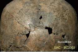 คำบรรยายภาพ : ภาพด้านหลัง กะโหลกศีรษะบน แสดงลักษณะ cranial porotic hyperostosis