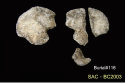 คำบรรยายภาพ : ภาพด้านหน้า กระดูกสะโพก ilium ซ้ายและขวา และ ischiumซ้าย