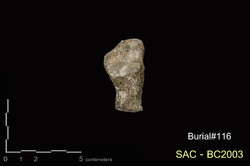 คำบรรยายภาพ : ภาพด้านบน กระดูกข้อเท้า calcaneus ขวา